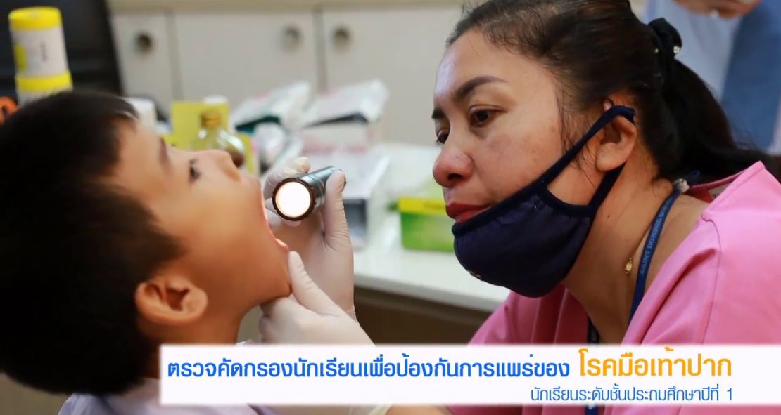 ตรวจคัดกรอง โรคมือเท้าปาก