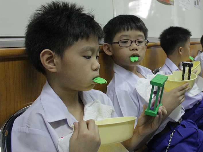 เคลือบฟลูออไรด์ป้องกันฟันผุ